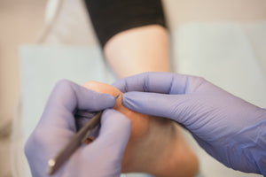 Waarom worden vervolgafspraken geannuleerd?