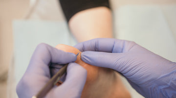 Waarom worden vervolgafspraken geannuleerd?