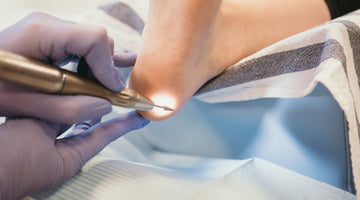 Waarom voetzorg een traject is en geen eenmalige behandeling